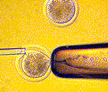 Clonación de embriones humanos